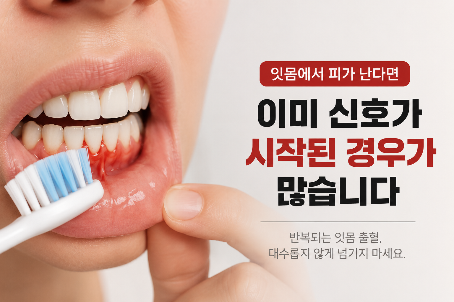 잇몸 관리
